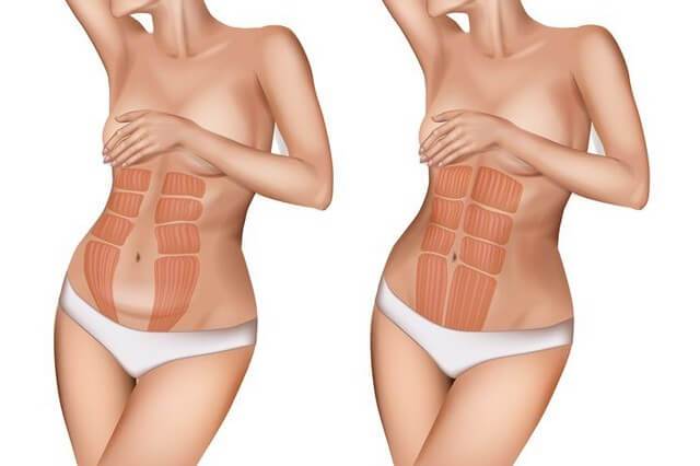 EM-Shape Duo - Schwangerschaft